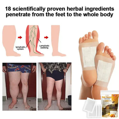 🌿 Buy 1 Get 1 FREE – Bee Venom Lymphatic Drainage & Slimming Foot Patches 👣